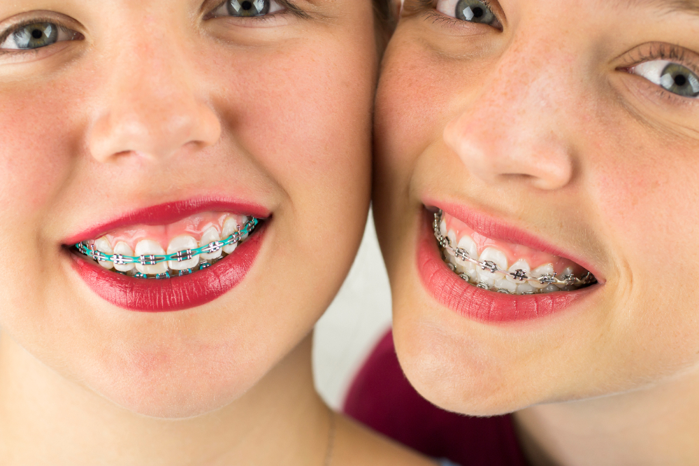 Childrens braces-317
